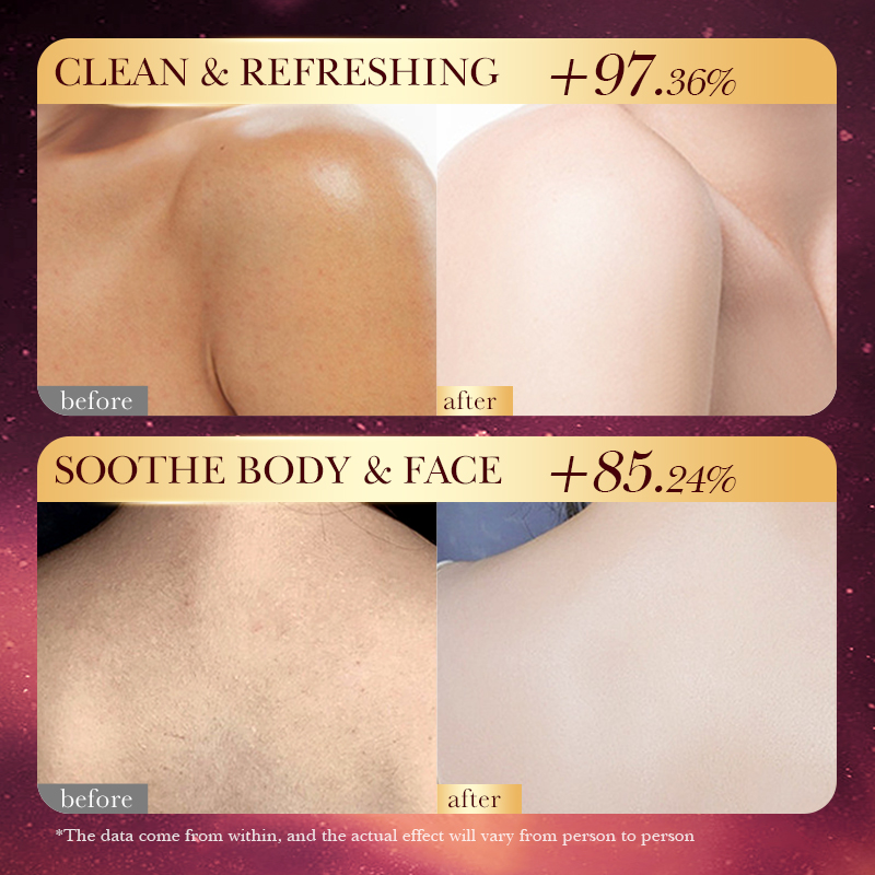 สบู่แฮนด์เมดสีโรสโกลด์ฟอยล์ –  - Luxury Gold Skincare บทวิจารณ์และราคา