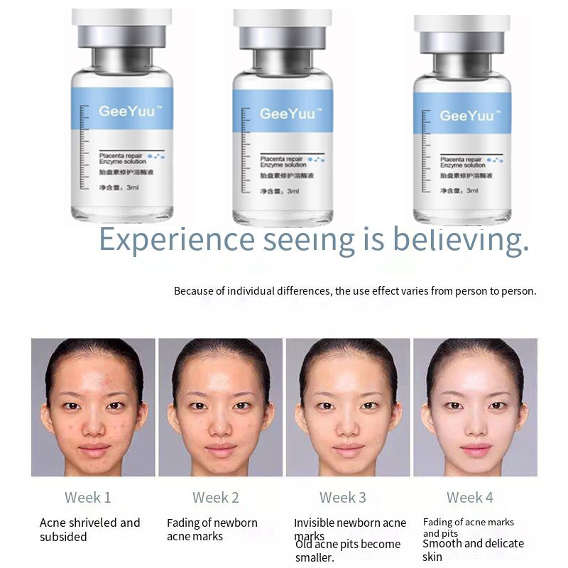 Placent Peptide Ampoule เซรั่ม - Placenta Extract Serum บทวิจารณ์และราคา
