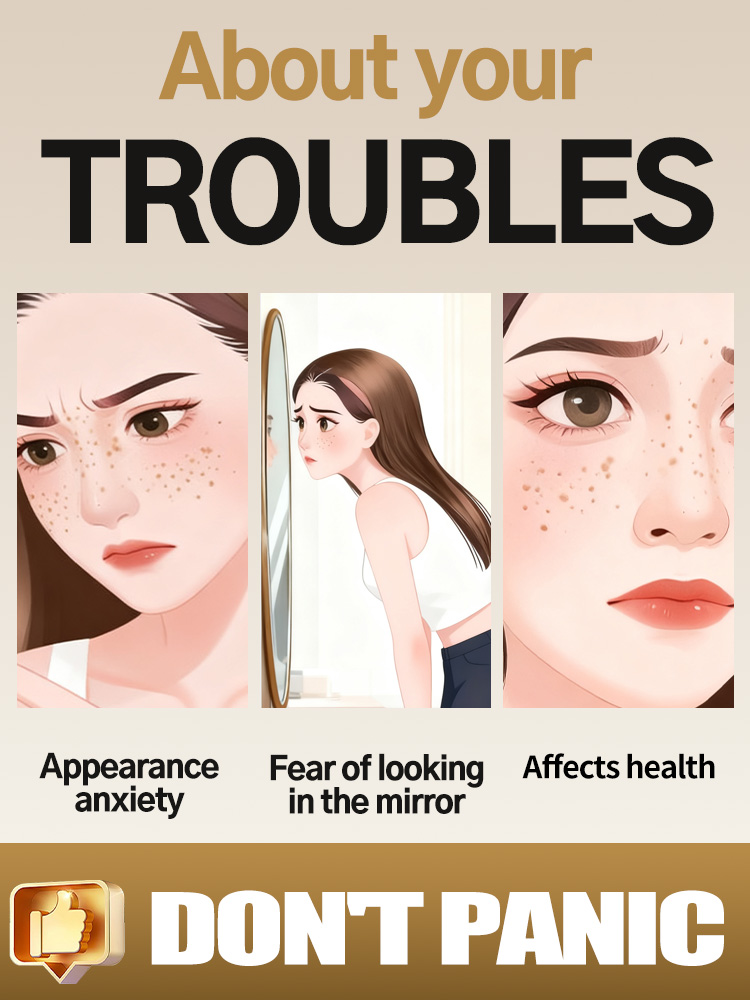 ลดเลือนฝ้า กระ จุดด่างดำบนใบหน - Skincare Luxury Whitening บทวิจารณ์และราคา