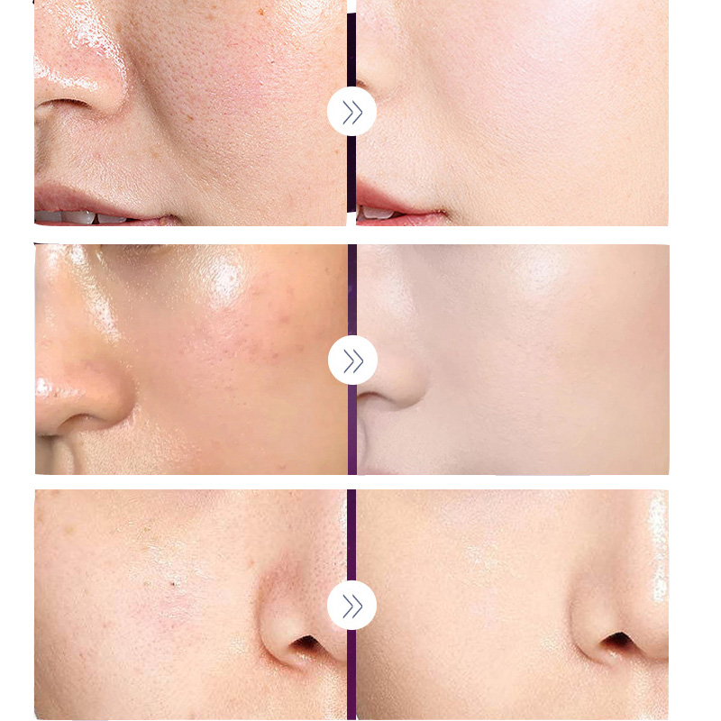 คอนซีลเลอร์บำรุงผิวหน้าครีมบำร - Skincare Luxury Whitening บทวิจารณ์และราคา